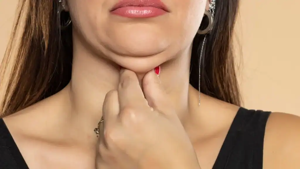 An image of a woman with double chin, sad, worried : Non Surgical Double Chin Removal Treatment in Marlow, UK
