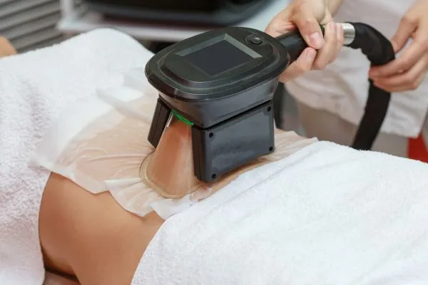 Image of person having fat freezing treatment to help weight gain Marlow