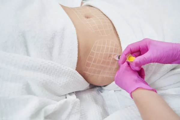 image of fat dissolving injections on love handles to help combat weight gain Marlow