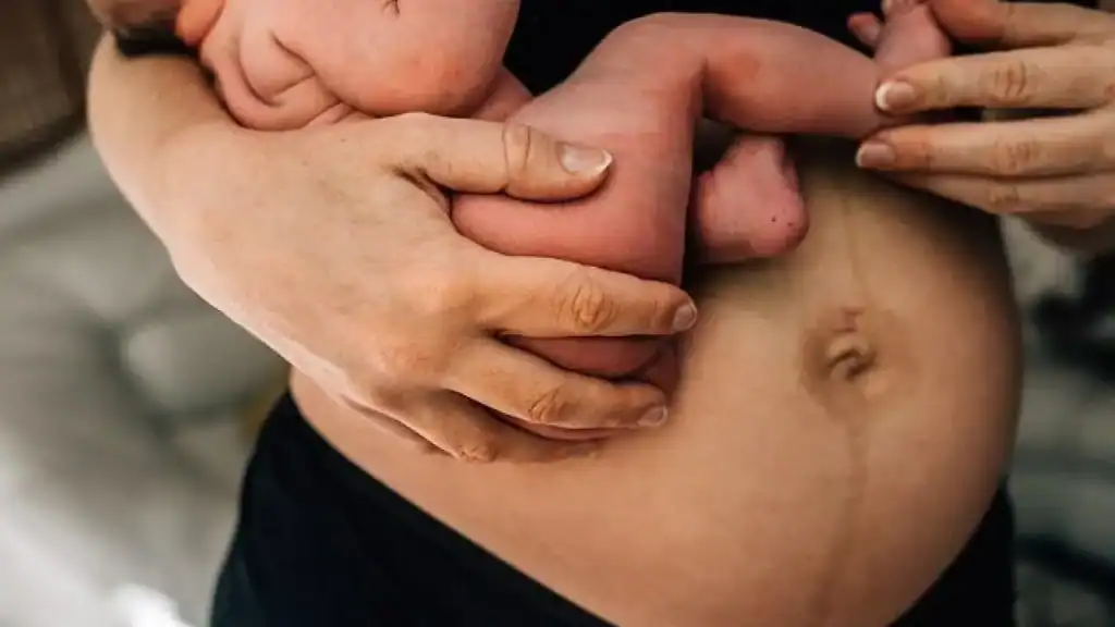 Why Is My Stomach Still Big After Pregnancy Marlow?